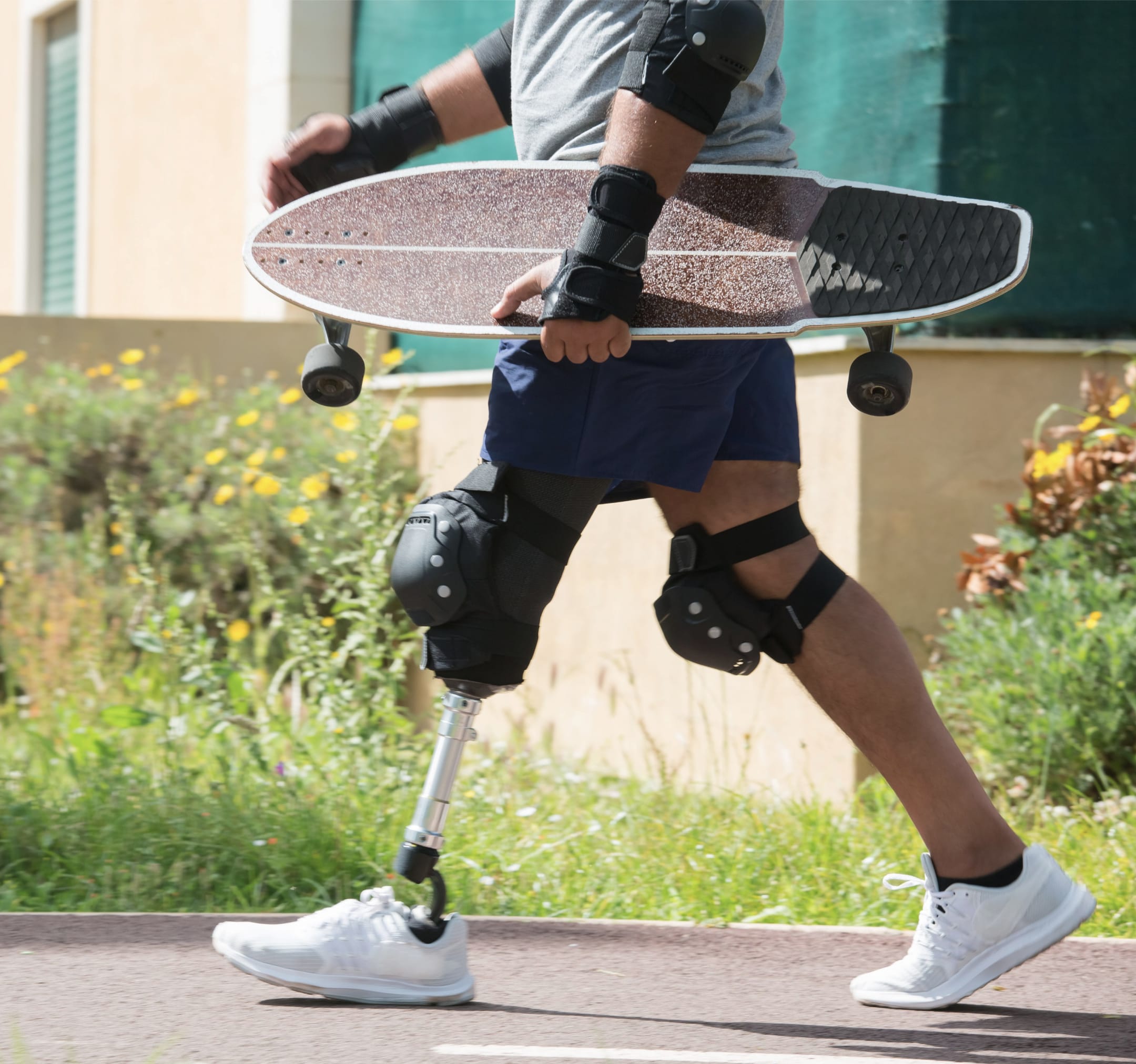 Skateboarder wearing an NK Gen 1 prosthetic knee